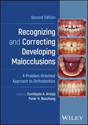 Recognizing And Correcting Developing Malocclusions - A Problem-Oriented Approach To Orthodontics, Second Edition